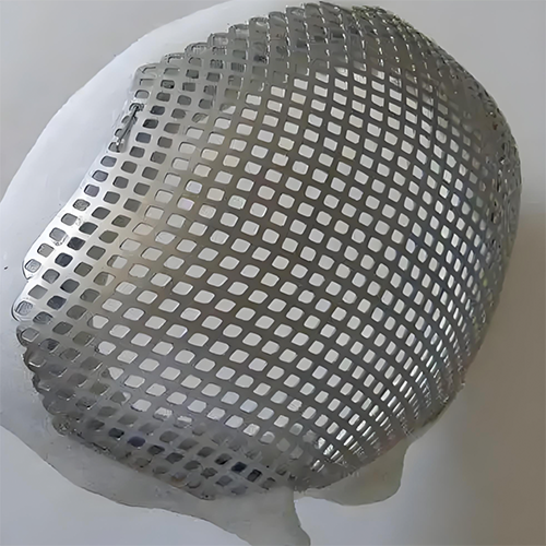 Titanium alloy Titanium alloy